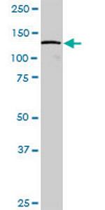 DDX42 Antibody in Western Blot (WB)