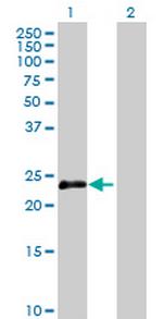 OIP5 Antibody in Western Blot (WB)