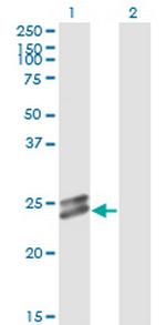 OIP5 Antibody in Western Blot (WB)