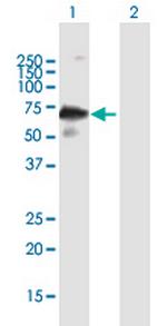 IKZF3 Antibody in Western Blot (WB)