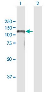 BAHD1 Antibody in Western Blot (WB)