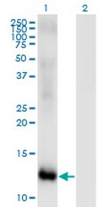 MSRB2 Antibody in Western Blot (WB)