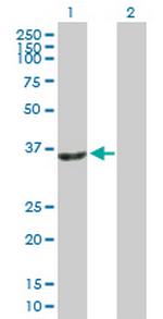 SIRT2 Antibody in Western Blot (WB)