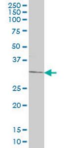 DKK1 Antibody in Western Blot (WB)