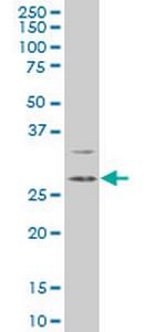 DKK1 Antibody in Western Blot (WB)