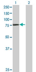 TRIM32 Antibody in Western Blot (WB)