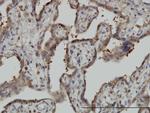 NT5C2 Antibody in Immunohistochemistry (Paraffin) (IHC (P))