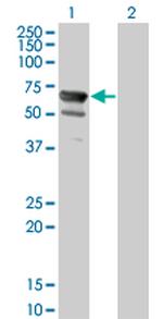 NT5C2 Antibody in Western Blot (WB)