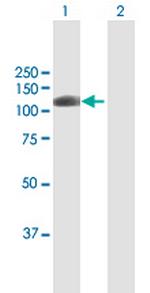 AOF2 Antibody in Western Blot (WB)