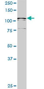 USP33 Antibody in Western Blot (WB)