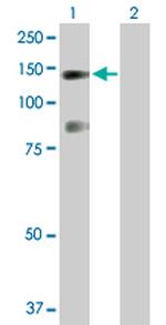 USP33 Antibody in Western Blot (WB)