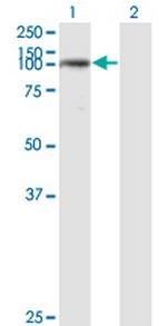 USP33 Antibody in Western Blot (WB)