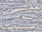 TXNDC4 Antibody in Immunohistochemistry (Paraffin) (IHC (P))