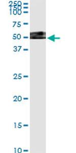 TXNDC4 Antibody in Immunoprecipitation (IP)