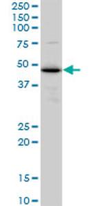 TXNDC4 Antibody in Western Blot (WB)