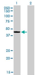 TXNDC4 Antibody in Western Blot (WB)