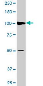 AGTPBP1 Antibody in Western Blot (WB)