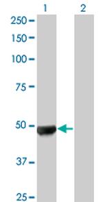 UBR2 Antibody in Western Blot (WB)