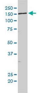 KIAA0056 Antibody in Western Blot (WB)