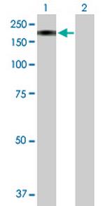 MAN2B2 Antibody in Western Blot (WB)