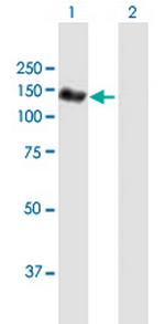 NEDD4L Antibody in Western Blot (WB)