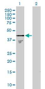 PHF15 Antibody in Western Blot (WB)