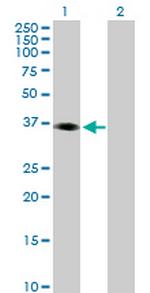 PHF15 Antibody in Western Blot (WB)