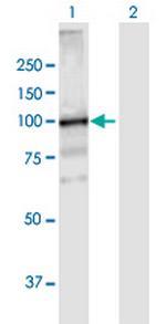 VPS39 Antibody in Western Blot (WB)