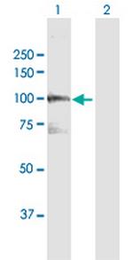 VPS39 Antibody in Western Blot (WB)