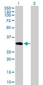 UNC84A Antibody in Western Blot (WB)