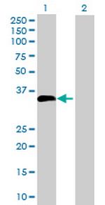 UNC84A Antibody in Western Blot (WB)