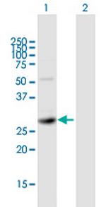 SIRT5 Antibody in Western Blot (WB)