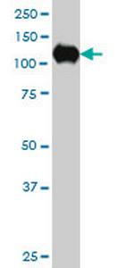 SIRT1 Antibody in Western Blot (WB)