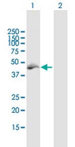 MLYCD Antibody in Western Blot (WB)