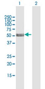 MLYCD Antibody in Western Blot (WB)