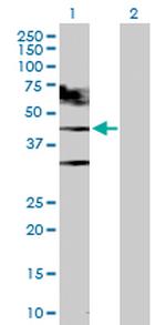 TARDBP Antibody in Western Blot (WB)