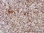 TARDBP Antibody in Immunohistochemistry (Paraffin) (IHC (P))