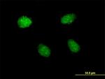 HEY1 Antibody in Immunocytochemistry (ICC/IF)