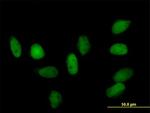 CBX5 Antibody in Immunocytochemistry (ICC/IF)