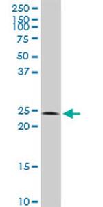 CBX5 Antibody in Western Blot (WB)