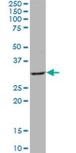 QPRT Antibody in Western Blot (WB)