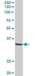 QPRT Antibody in Western Blot (WB)