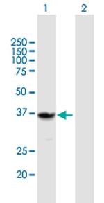 QPRT Antibody in Western Blot (WB)