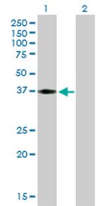 HEY2 Antibody in Western Blot (WB)