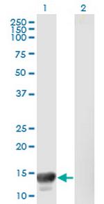 MACF1 Antibody in Western Blot (WB)