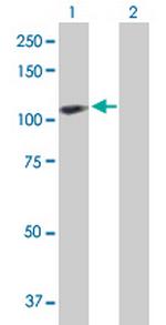 CENTB2 Antibody in Western Blot (WB)