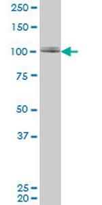 ZNF281 Antibody in Western Blot (WB)