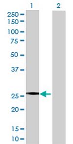 NNT Antibody in Western Blot (WB)