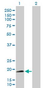 NNT Antibody in Western Blot (WB)