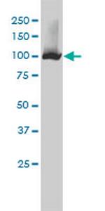 NNT Antibody in Western Blot (WB)